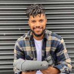 Nate Macabuag with a Koalaa soft prosthetic